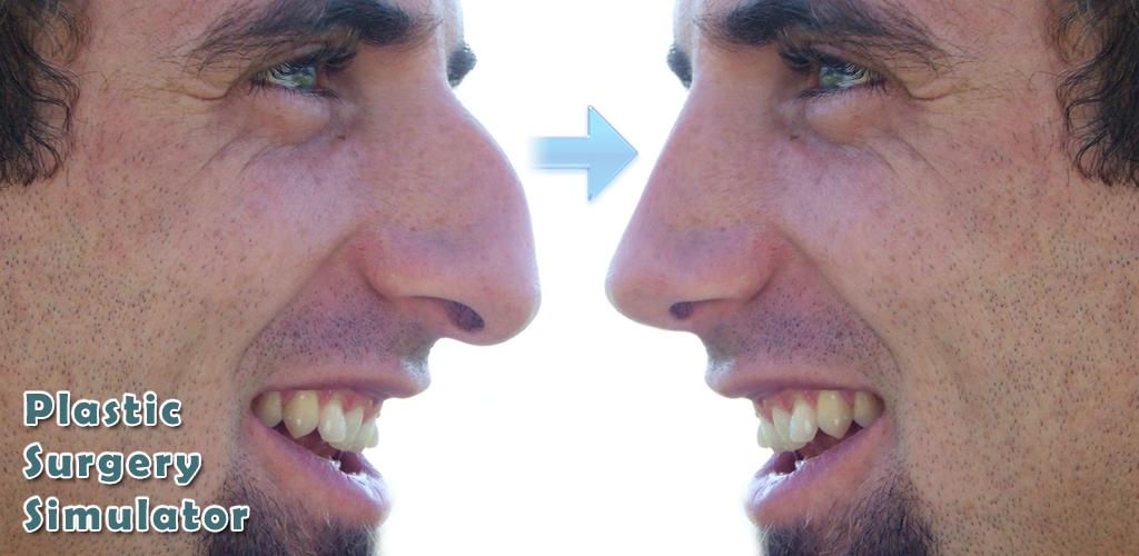 Plastic Surgery Simulator