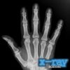 X Ray Scanner